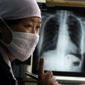 Китай борется с туберкулезом